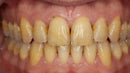 Ilustração de higiene oral