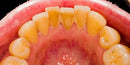 Saúde dental