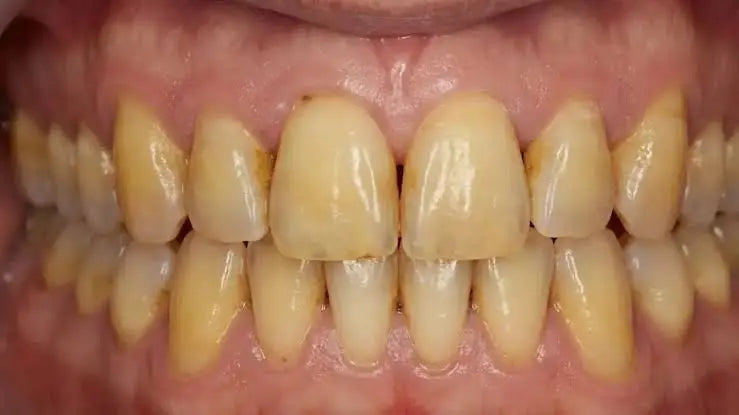 Ilustração de higiene oral